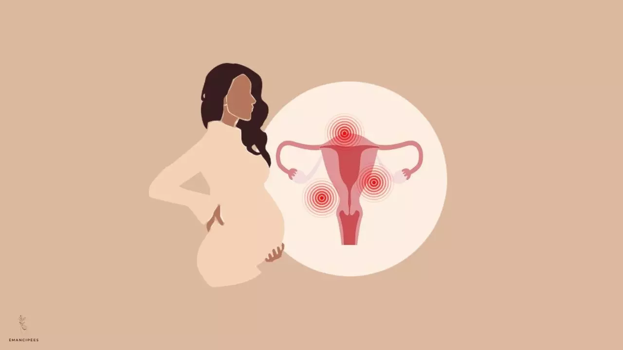 endométriose fertilité