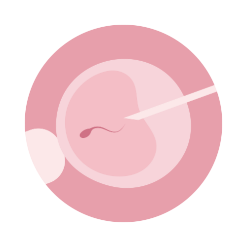 fécondation in vitro, fiv