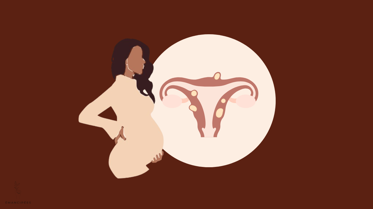 fibrome utérin grossesse