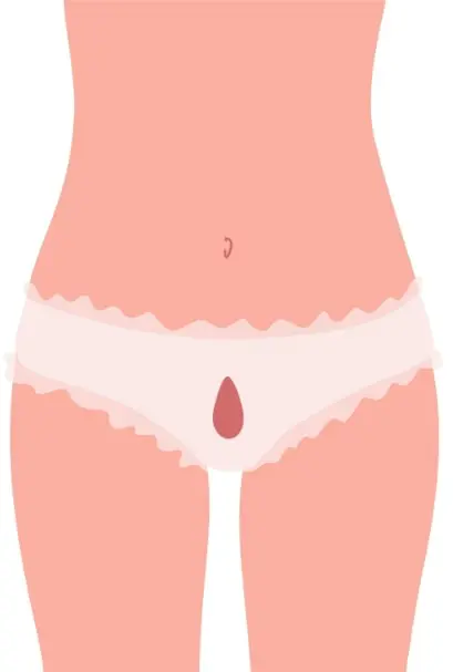 impact de l'hypothyroïdie sur le cycle menstruel et les règles