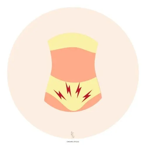 syndrome prémenstruel